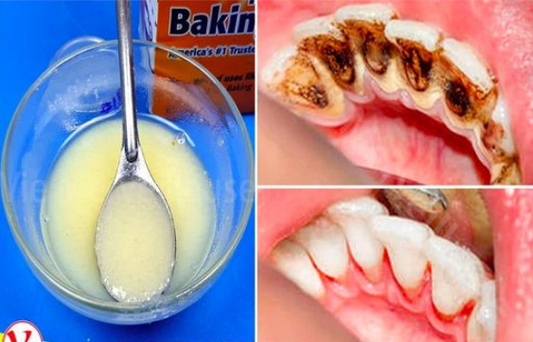 La recette ultime pour un dentifrice maison éliminant efficacement la plaque dentaire