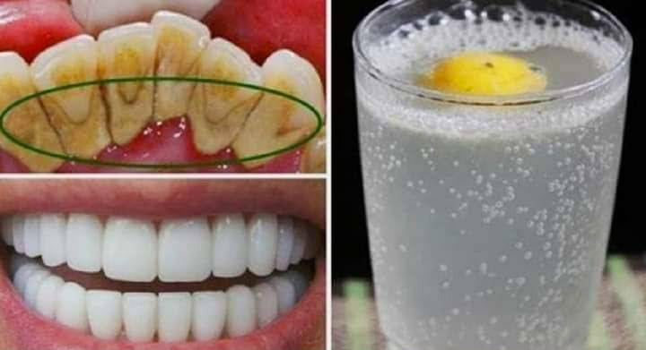 Voici 5 techniques naturelles pour éliminer la plaque dentaire