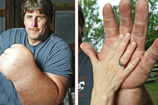 Jeff Dabe : L'homme aux plus grosses mains de la Terre !