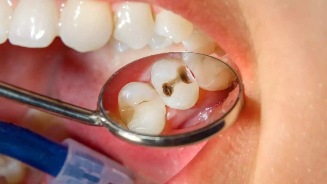 Attention ! Vos dents peuvent tuer : découvrez comment les maladies buccodentaires causent les maladies cardiovasculaires, les AVC et les cancers