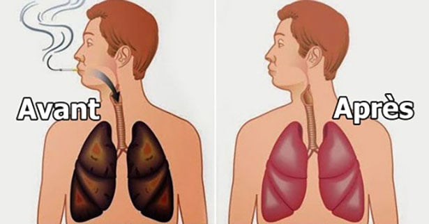 Voici les astuces alimentaires clés pour nettoyer les poumons des fumeurs et améliorer leur santé respiratoire